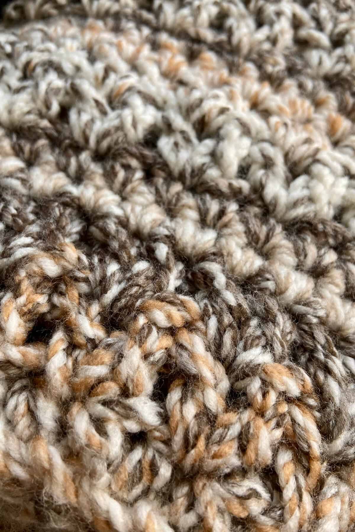 Close up of stitches.